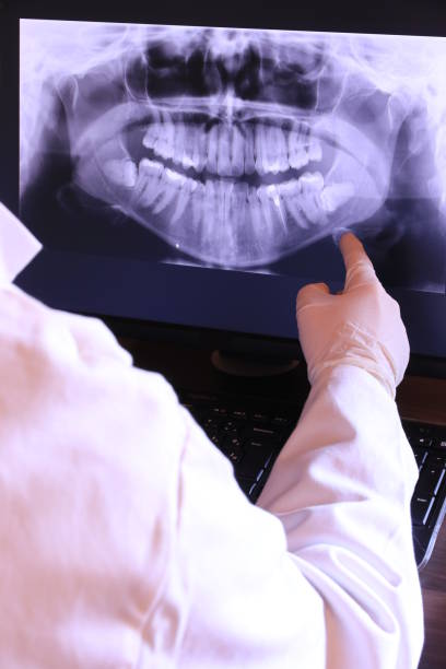 Best Broken Tooth Emergency  in Dundee, FL