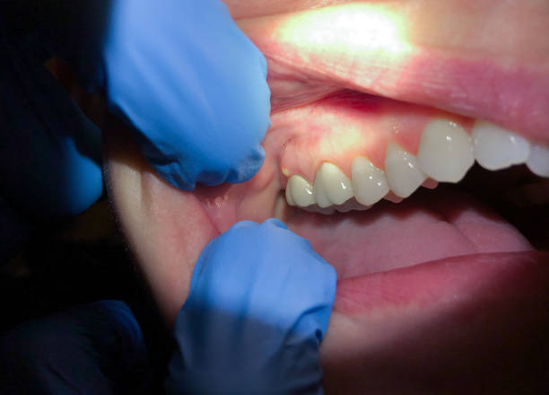 Best Emergency Gum Pain Relief  in Dundee, FL