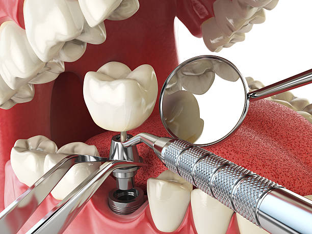 Dentist for Dental Trauma in FL