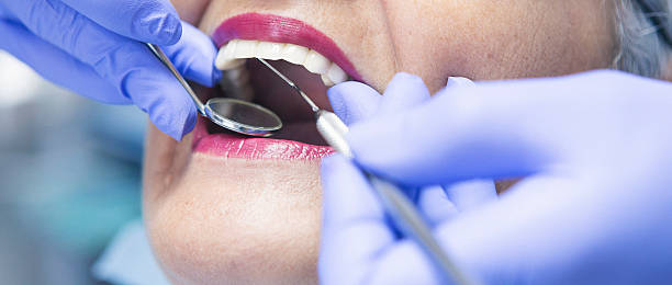 Best Knocked-Out Tooth Emergency  in Dundee, FL